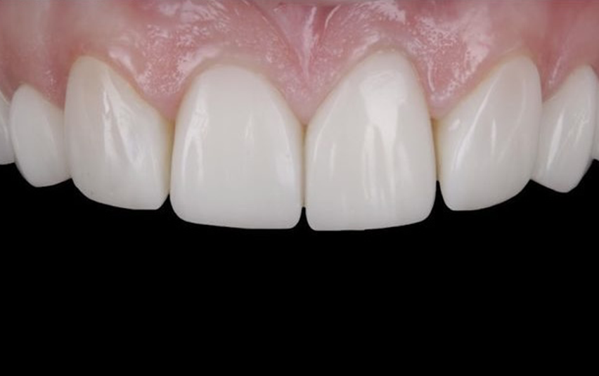 After - Midsummer Dental