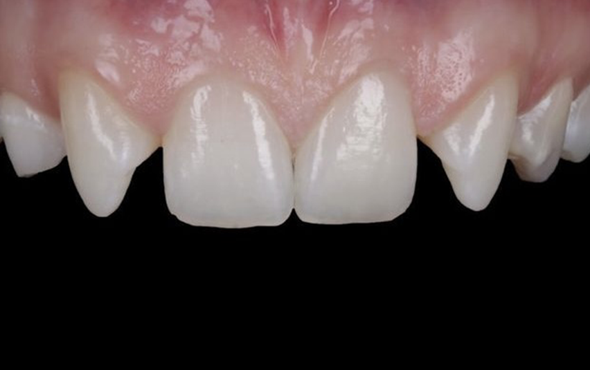 Before - Midsummer Dental