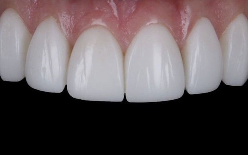 After - Midsummer Dental