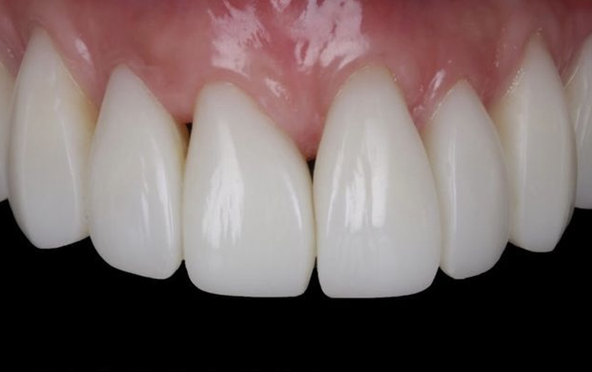 After - Midsummer Dental