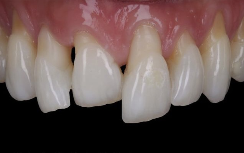 Before - Midsummer Dental